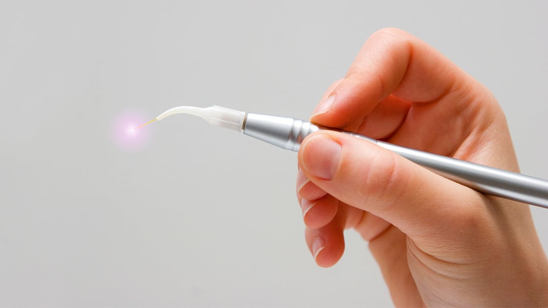 Person Holding Dental Laser